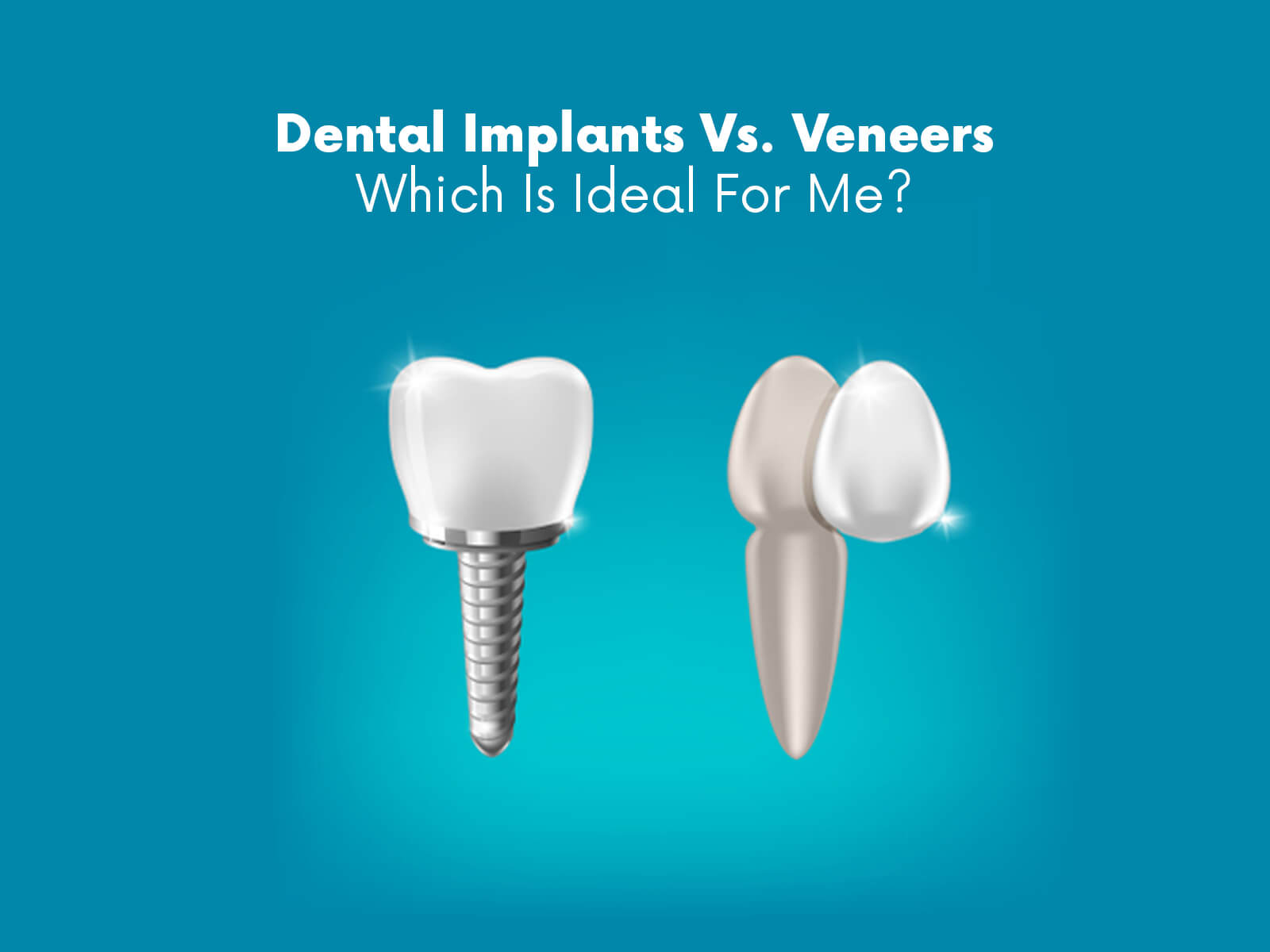 Dental Implants Vs. Veneers: Which Is Ideal For Me?