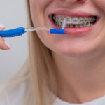 Maintaining Good Oral Hygiene During Orthodontic Treatment