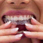 How To Get Effective Relief From Invisalign Pain