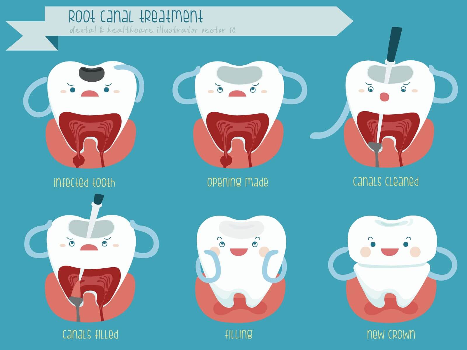 4 Tips For Choosing A Dentist For Root Canal Treatment