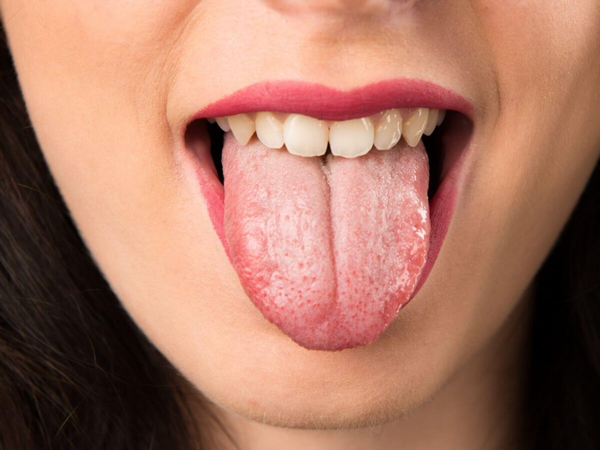 The Ultimate Guide To Foods That Beat Dry Mouth